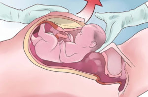 40 Неделя беременности рези во влагалище