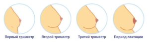 Болит Ли Грудь В Первые Недели Беременности