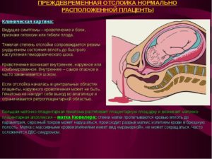 Толстая плацента при беременности причины и последствия