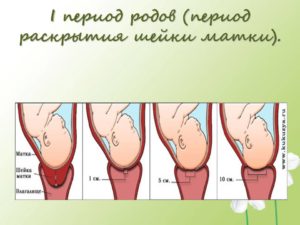 Если матка открылась на 1 палец когда рожать