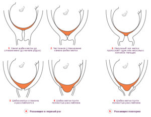 Шейка мягкая пропускает 2 пальца когда роды