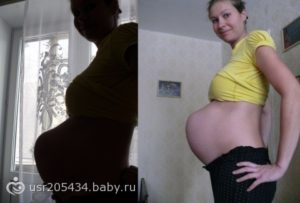 Ноет низ живота и поясница при беременности 38 недель
