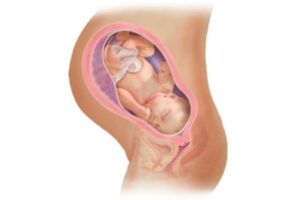 Жидкий стул на 38 неделе беременности через сколько роды