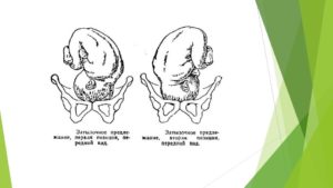 Положение плода продольное предлежание головное 1 позиция передний вид