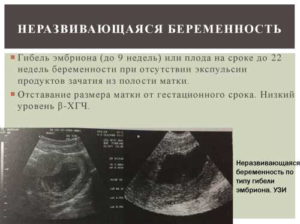 Неразвивающаяся беременность 7 недель