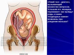 Низко расположена головка плода на 30 неделе