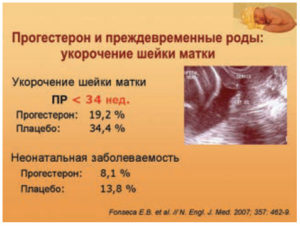Укорочение шейки матки при беременности 27 недель