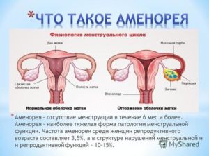 Месячные в 48 лет особенности