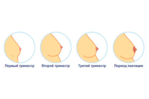 Болит грудь на первых неделях беременности