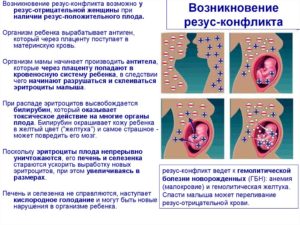 Резус Конфликт Матери И Ребенка При Кормлении