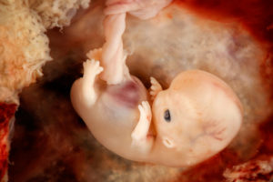 Эмбрион человека 7 недель фото