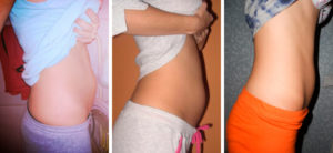 5 Недель беременности фото животиков
