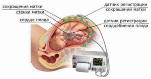 Как Разбудить Ребенка В Животе Перед Ктг