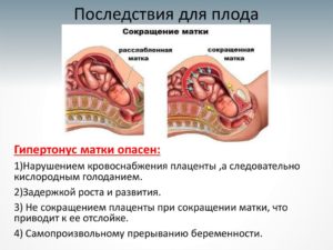 Сколько лежат в больнице с тонусом матки при беременности