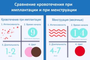 Чем Месячные Отличаются От Кровотечения При Беременности