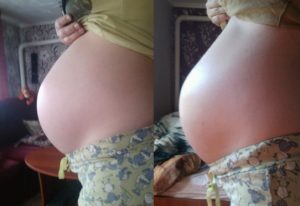 Опустился живот в 36 недель когда рожать