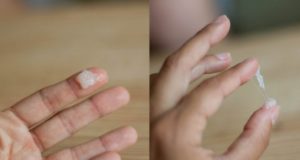 Обильные прозрачные выделения 19 недель