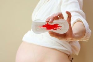 Обильные месячные в первый месяц во время беременности