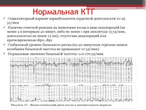 Как Подготовиться К Ктг При Беременности