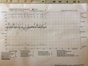 Начальные Нарушения Состояния Плода При Ктг Причины