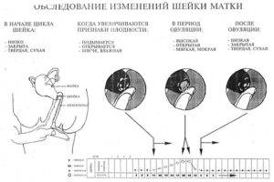 Какая должна быть шейка матки при беременности на ранних сроках