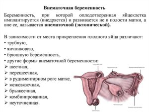 Растет матка при внематочной беременности