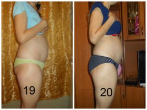 Тянет живот на 18 неделе беременности