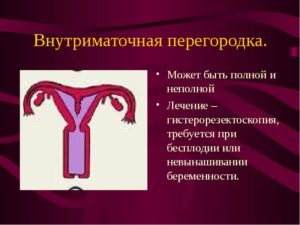 Перегородка в матке при беременности причины и последствия