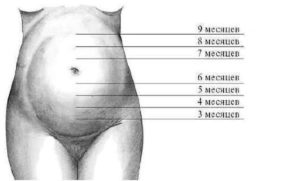 Высота дна матки на 14 неделе беременности