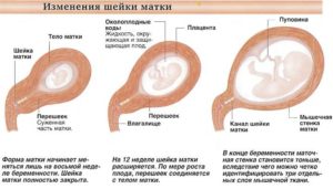 Болит шейка матки при беременности на ранних сроках