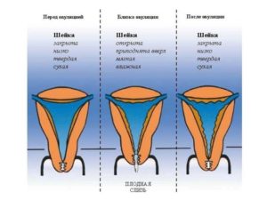 Твердая или мягкая матка при беременности