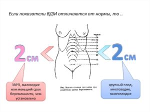 Высота матки 23 неделе беременности