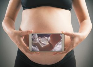 На 25 неделе беременности тонус матки
