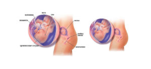 Где находится плод на 17 неделе беременности