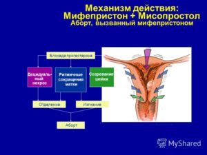 Почему не действует мифепристон перед родами