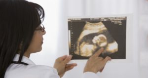 Маловодие на 31 неделе беременности