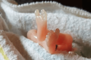 Как выглядит эмбрион в 4 недели при выкидыше фото