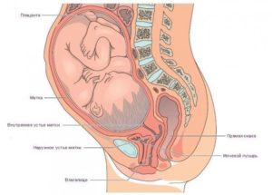 На матку давит при беременности