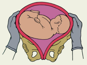 При беременности ребенок низко лежит