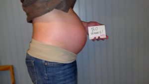 Фото живота 20 неделя беременности