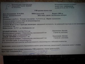 В позадиматочном пространстве свободная жидкость при беременности