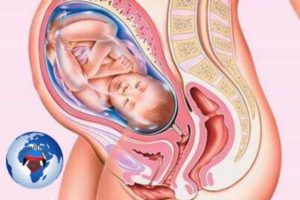 34 недели беременности матка в тонусе