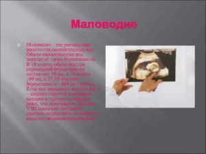 Диагностика аномалий развития и заболеваний элементов плодного яйца