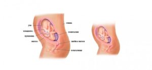 36 Неделя беременности режущие боли
