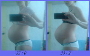 При беременности 34 недели тянет низ живота