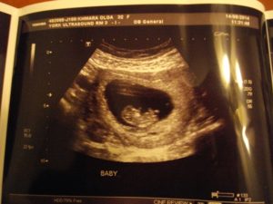 9 Недель и 2 дня беременности форум