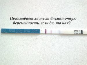 При Внематочной Беременности Тест Показывает Положительный Результат