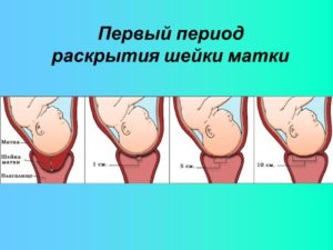 Раскрытие шейки матки на 2 пальца сколько это сантиметров