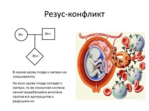 Резус Конфликт Матери И Ребенка При Кормлении