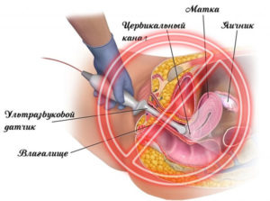 Делают ли трансвагинальное узи девственницам